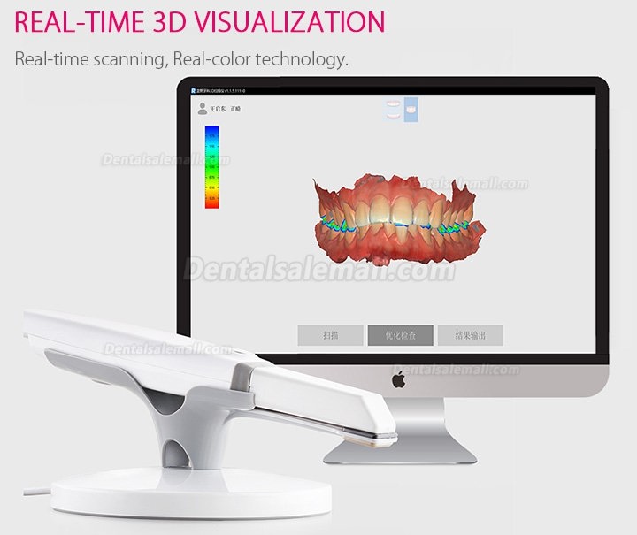 Runyes 3DS Dental 3D Digital Intraoral Scanner Powderless Real Color Scanning